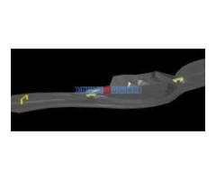 Izrada DTM-a u AutoCAD Civil 3D-u - Fotografija 3/6